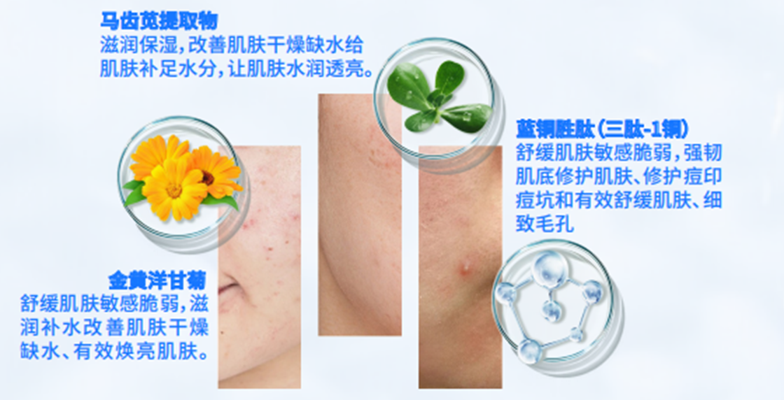蓝铜肽冻干粉核心成分与护理功效