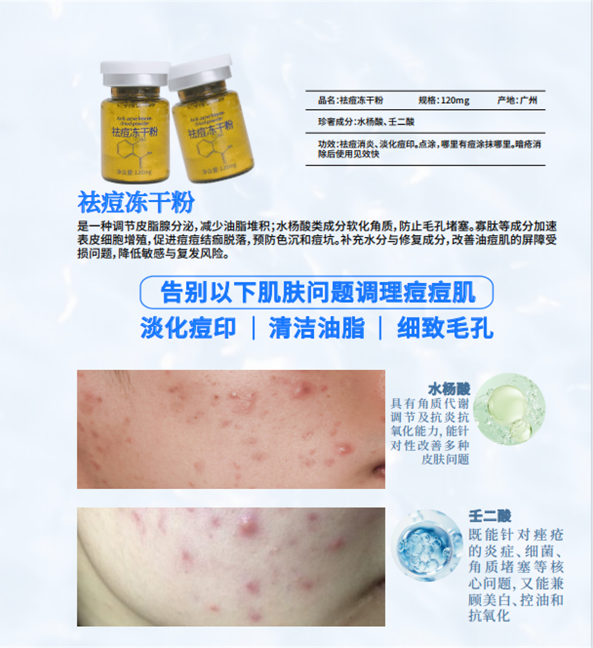 祛痘冻干粉产品成分与护理功效