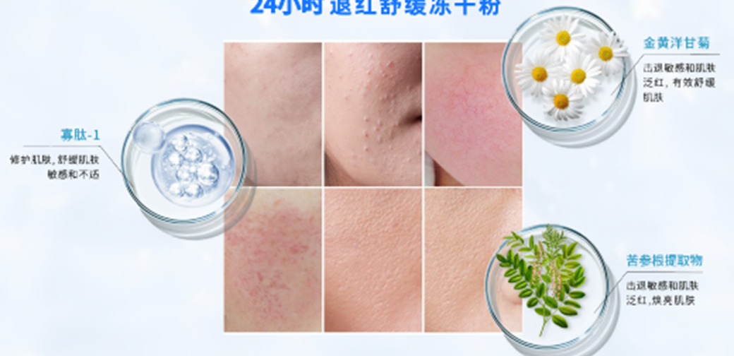 退红舒缓冻干粉核心成分与护理功效